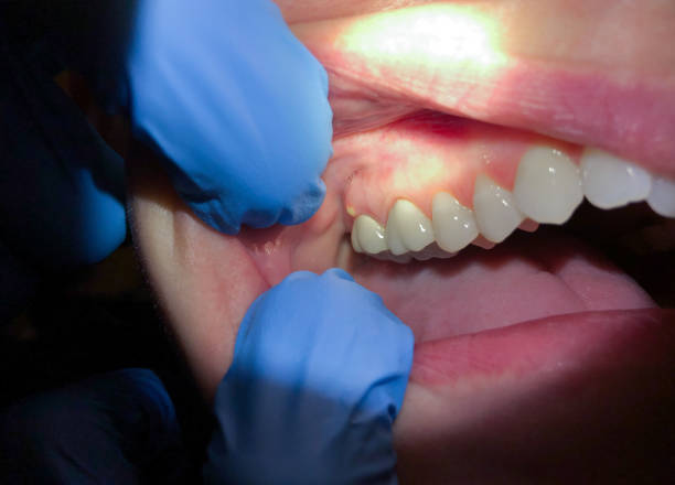 Best Cosmetic Emergency Dentistry in Stevens Point, WI