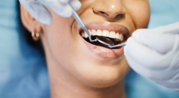 Best Emergency Tooth Extraction in Stevens Point, WI