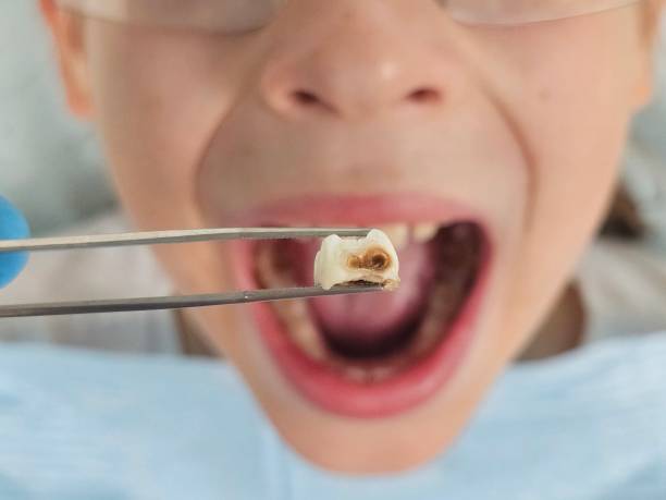 Best Emergency Denture Repair in Stevens Point, WI
