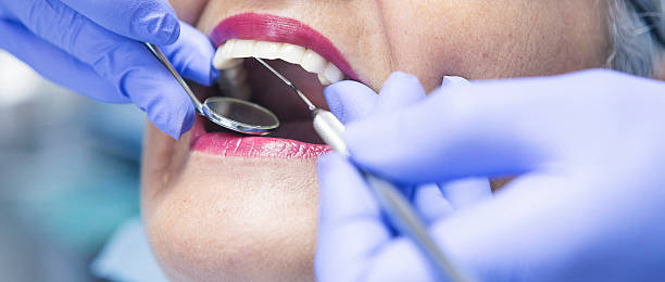 Best Emergency Treatment for Dental Infections or Abscesses in Stevens Point, WI