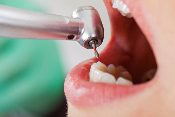 Best Pediatric Emergency Dentist in Stevens Point, WI